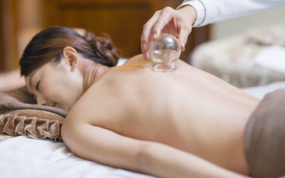 Cupping Therapeutic Massage (55 min.)